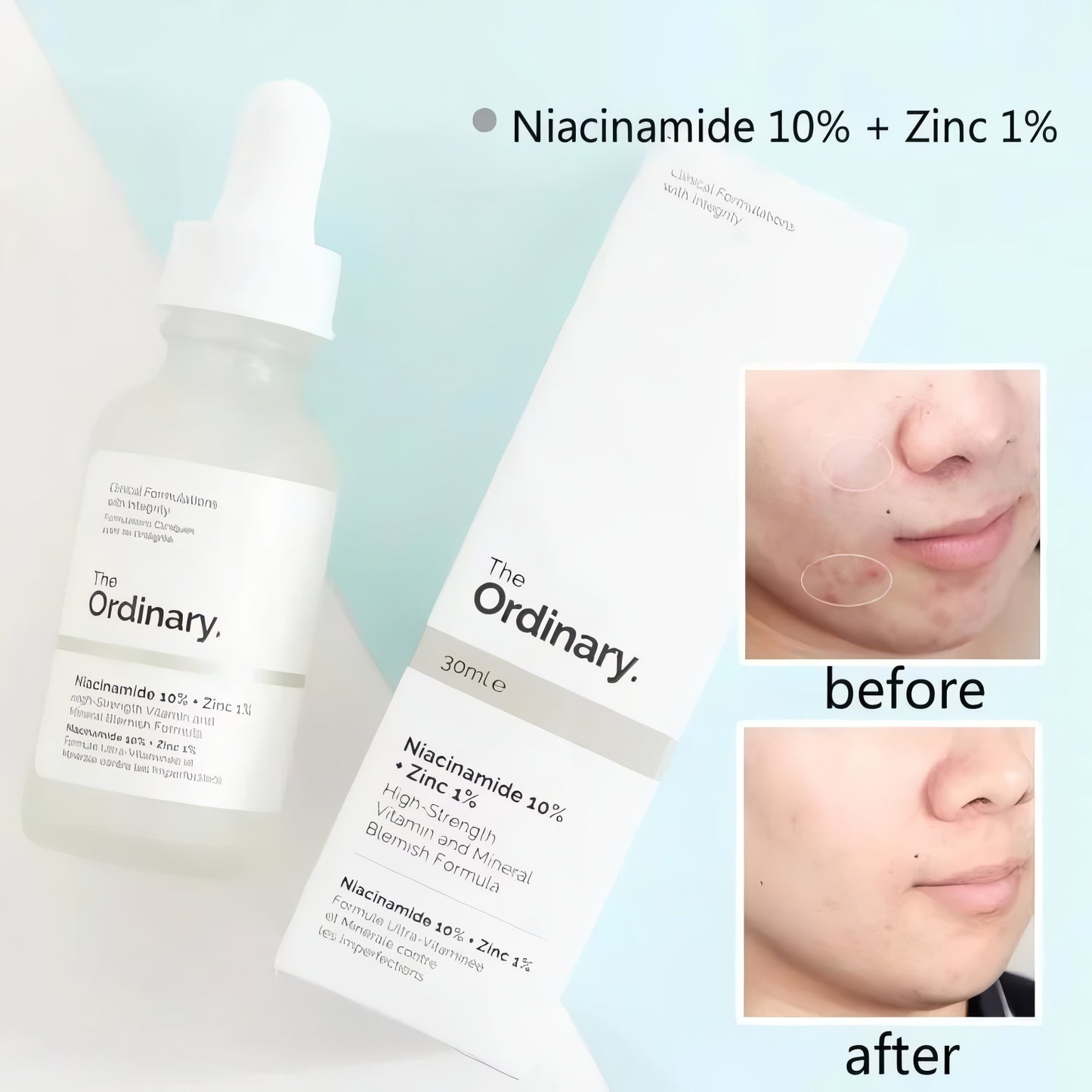 Skin Brightening Niacinamide Serum 30ml