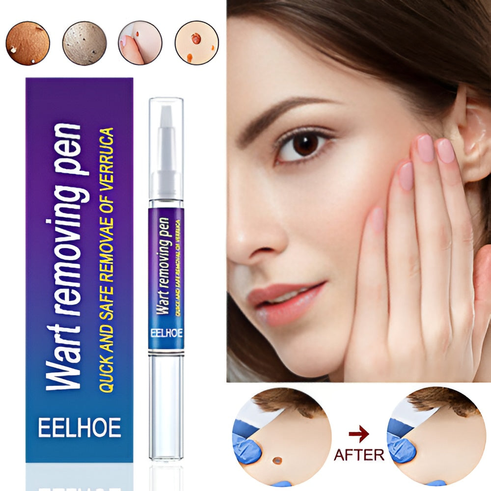 Quick Wart/Mole Removal Pen